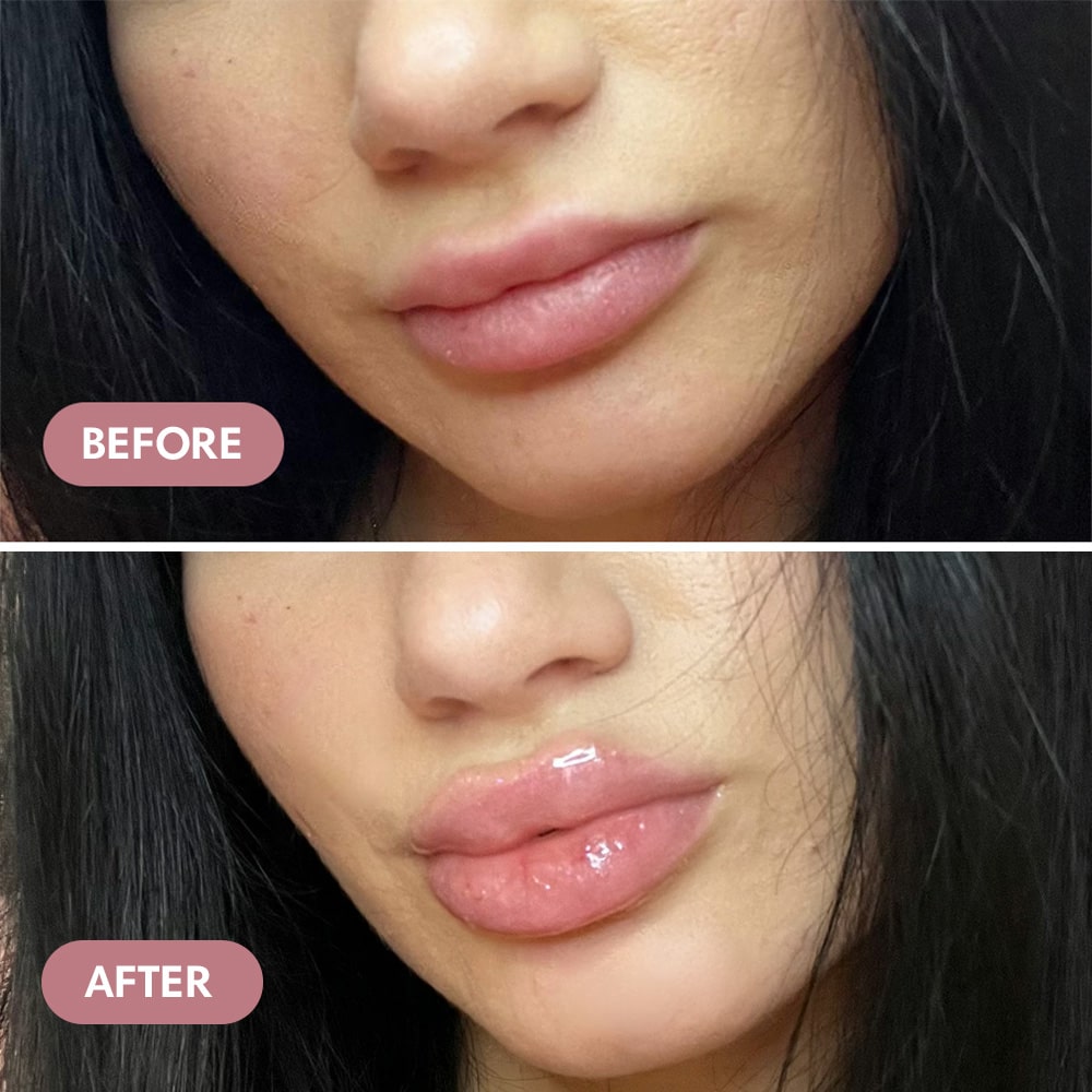 Extreme Lip Plumper