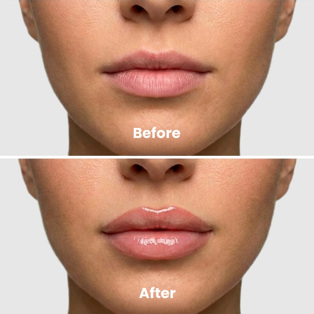 Extreme Lip Plumper
