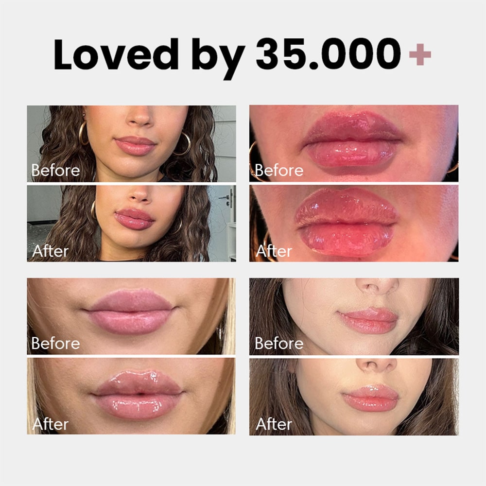 Extreme Lip Plumper