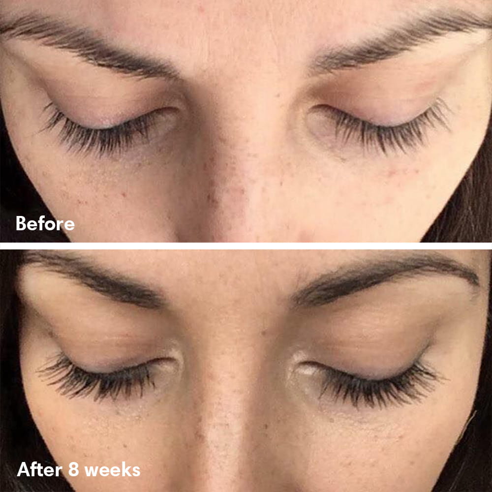 Eyelash Serum
