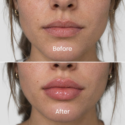 Extreme Lip Plumper